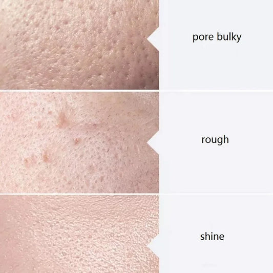 Facial Skincare Face Serum Hydro Aqua Peel Solution 400ml Kit of 3 Serums AS1 SA2 AO3 For facial Machine Skin Deep Cleaning - Merit Sell