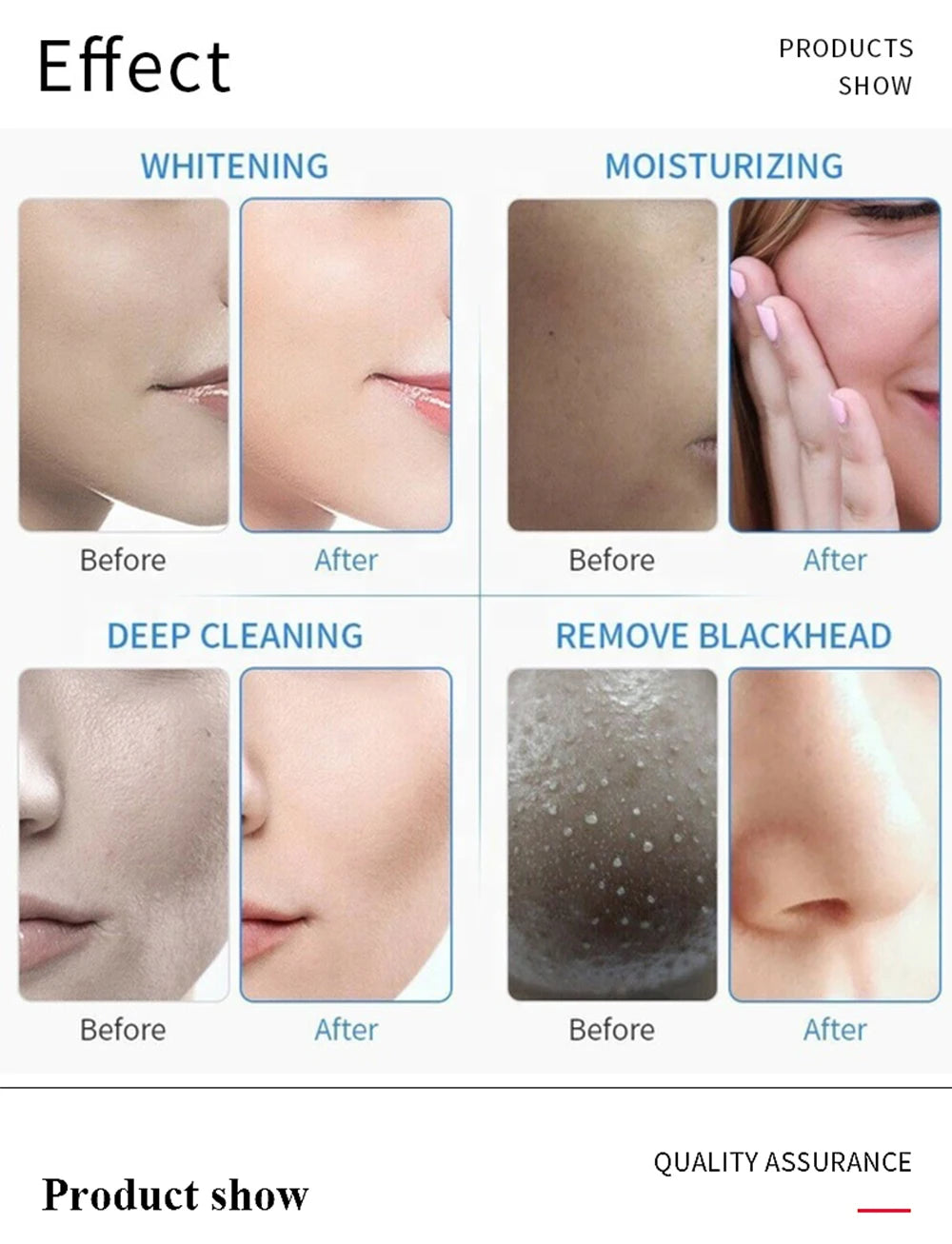 Oxygen Water Spray Jet Professional Skin Care Tool For Skin Anti Wrinkle Rejuvenation Oxygen Jet Facial Machine - Merit Sell