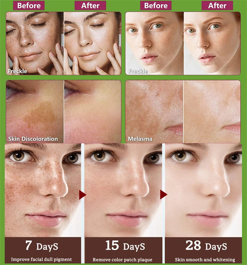 Effective Whitening Serum Remove Dark Spots Freckle Essence Anti-Aging Fade Pigmentation Melasma Brighten Beauty Face Skin Care