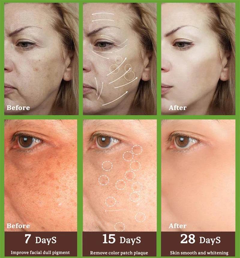 Effective Whitening Serum Remove Dark Spots Freckle Essence Anti-Aging Fade Pigmentation Melasma Brighten Beauty Face Skin Care