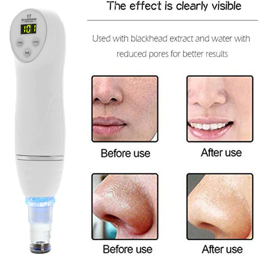 Diamond dermabrasion skin peeling beauty machine vacuum blackhead acne remove face cleaning facial Pore Cleaner equipment - Merit Sell