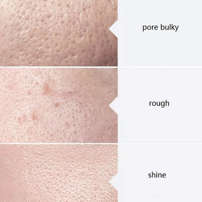 Facial Skincare Face Serum Hydro Aqua Peel Solution 400ml Kit of 3 Serums AS1 SA2 AO3 For facial Machine Skin Deep Cleaning - Merit Sell