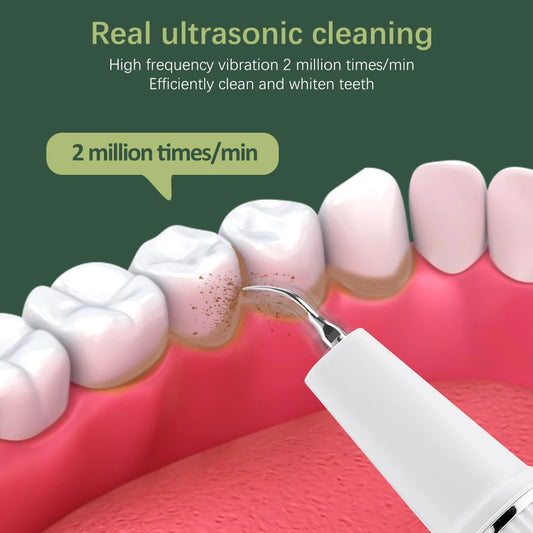 Portable Oral Irrigator Ultrasonic Calculus Remover Electric Teeth Whitening Dental Scaler Plaque Stains Tartar Home Oral Care