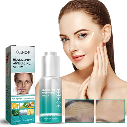 Effective Whitening Serum Remove Dark Spots Freckle Essence Anti-Aging Fade Pigmentation Melasma Brighten Beauty Face Skin Care