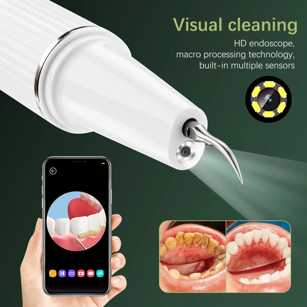 Portable Oral Irrigator Ultrasonic Calculus Remover Electric Teeth Whitening Dental Scaler Plaque Stains Tartar Home Oral Care