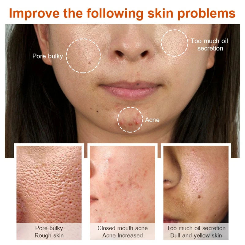 Effective Whitening Serum Remove Dark Spots Freckle Essence Anti-Aging Fade Pigmentation Melasma Brighten Beauty Face Skin Care