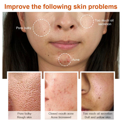 Effective Whitening Serum Remove Dark Spots Freckle Essence Anti-Aging Fade Pigmentation Melasma Brighten Beauty Face Skin Care
