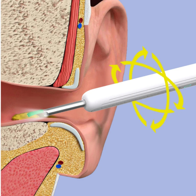 Wireless WiFi Ear Pick Otoscope Camera Borescope Luminous Ear Wax Cleaning Teeth Oral Inspection Health Care Ear Cleaner Tool - Merit Sell
