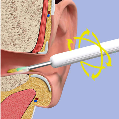 Wireless WiFi Ear Pick Otoscope Camera Borescope Luminous Ear Wax Cleaning Teeth Oral Inspection Health Care Ear Cleaner Tool - Merit Sell